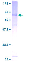 12.5% SDS-PAGE Stained with Coomassie Blue.
